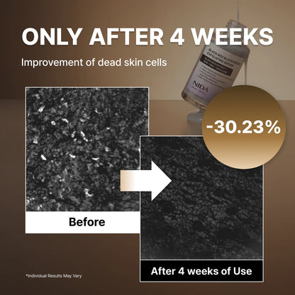 NIDA White Rice Whitehead Exfoliating Serum