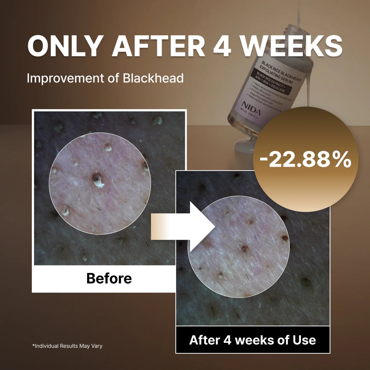 NIDA White Rice Whitehead Exfoliating Serum