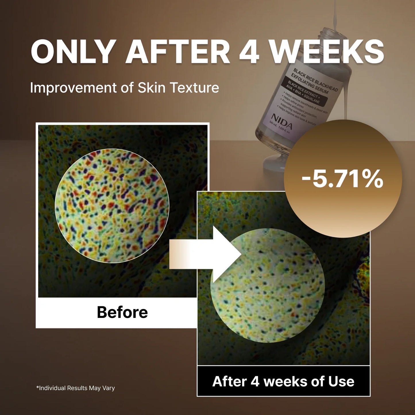 NIDA White Rice Whitehead Exfoliating Serum