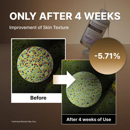 NIDA White Rice Whitehead Exfoliating Serum