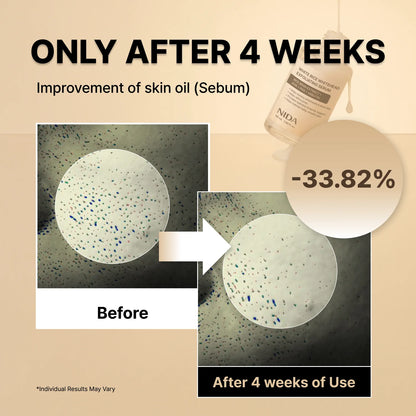 NIDA White Rice Whitehead Exfoliating Serum